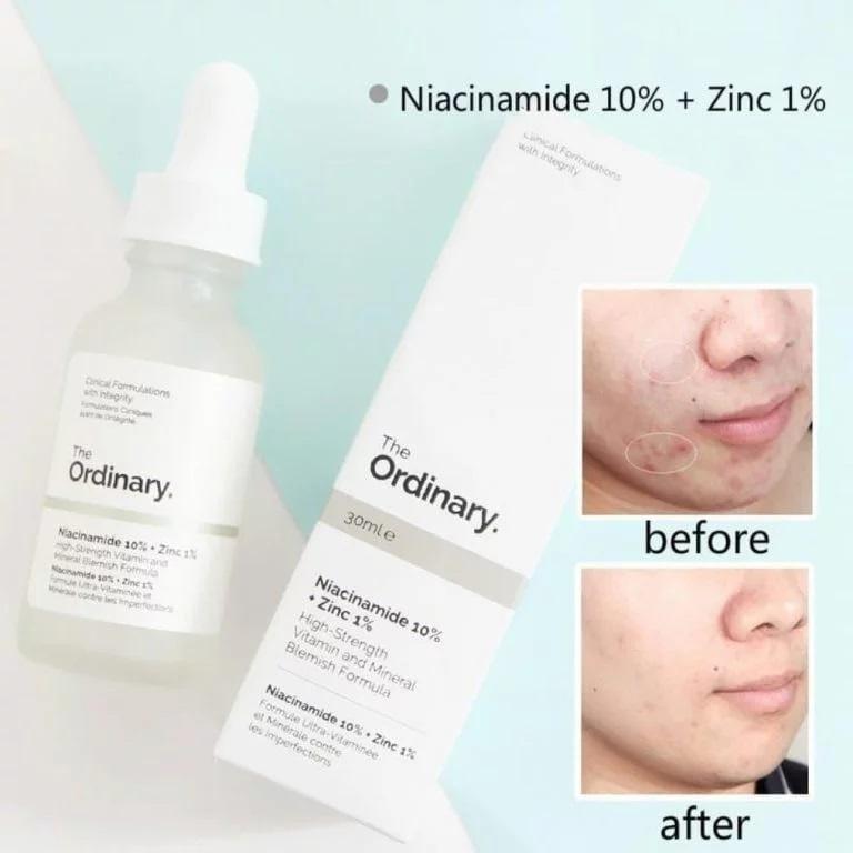 Skin Brightening Niacinamide Serum bottle for radiant and even-toned skin