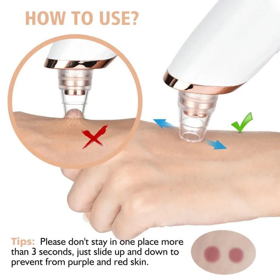 Derma Suction Facial Cleanser with easy-to-clean design for blackhead removal and pore cleansing