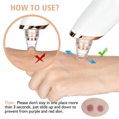 Derma Suction Facial Cleanser with easy-to-clean design for blackhead removal and pore cleansing