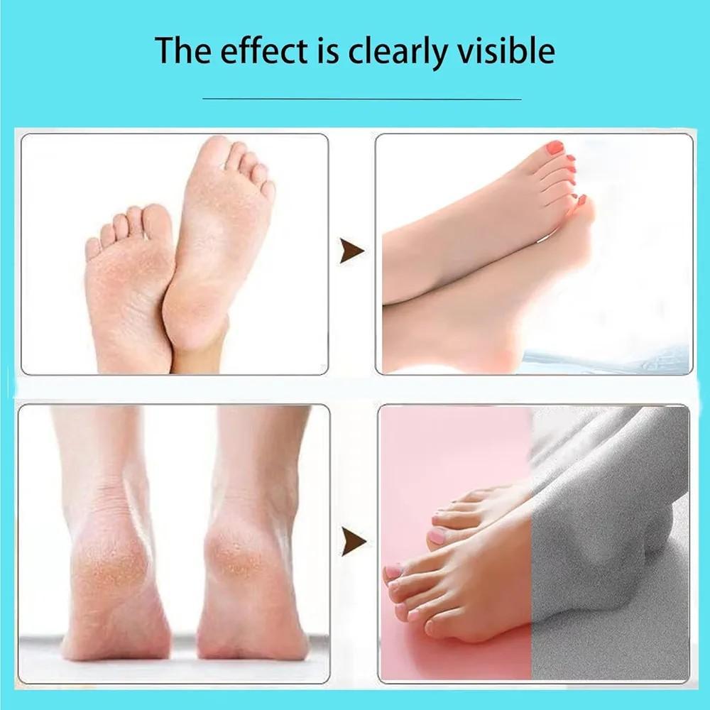 Electric callus remover for dead skin and cracked heels foot care tool