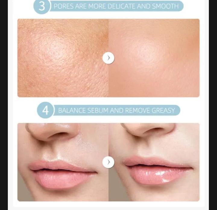 Uptown La Blemish Removal Retinol Serum for acne scars and anti-aging